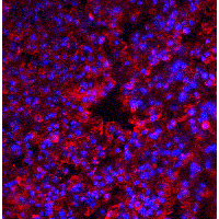 IHC-plus™ EIF2AK2 / PKR Antibody