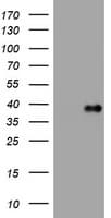 PIK3C2A Antibody (aa230-560, clone OTI3C10)