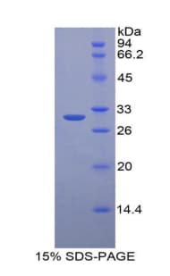 Mouse HGD Protein (Recombinant His-T7)