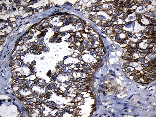 SLC9A1BP / CHP Antibody (clone OTI4B9)