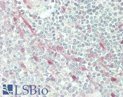 IHC-plus™ YAP / YAP1 Antibody (aa350-400)
