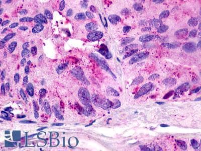 PathPlus™ Polyclonal Rabbit anti-Human GPR21 Antibody (Transmembrane Domain, IHC)