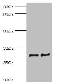 ATP5F1 Antibody (aa1-245)