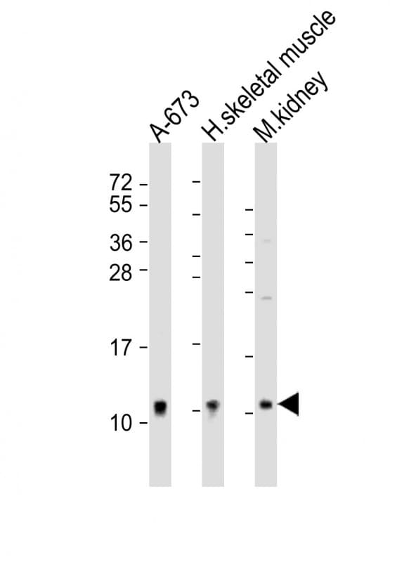 NDUFA1 Antibody (aa26-59)