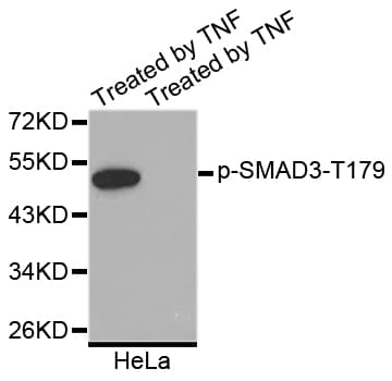 SMAD3 Antibody (phospho-Thr179)