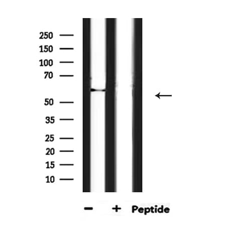 HDAC2 Antibody (phospho-Ser394)