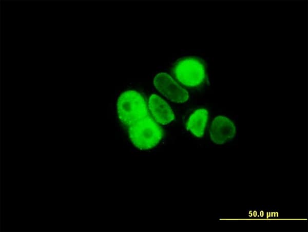 PR / Progesterone Receptor Antibody (clone 5D10)