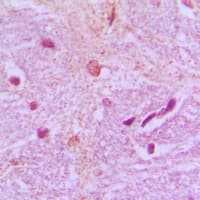 TBX15+18 Antibody (Internal)