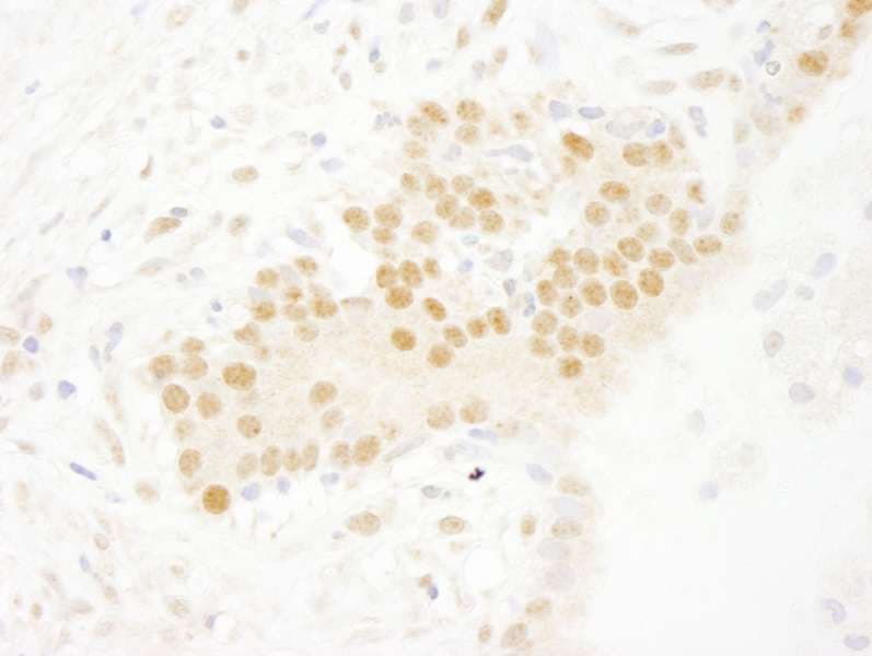 SETD7 / SET7 Antibody (aa316-366)