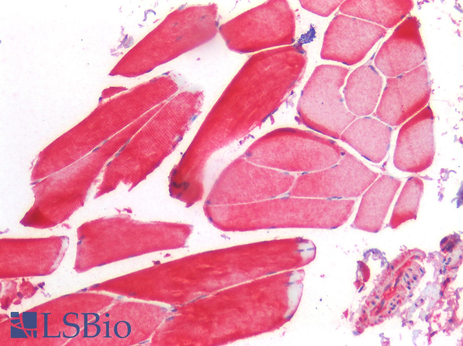 PathPlus™ TIMP2 Antibody (clone F27P3A4)