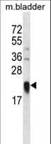 MD-1 / LY86 Antibody (aa98-127)
