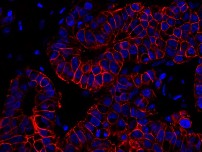 Polyclonal Rabbit anti-Human ERBB2 / HER2 Antibody (aa1200-C-term, IHC, IF)
