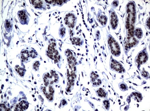 Monoclonal Mouse anti-Human MGMT Antibody (clone UMAB56, Carrier-free, IHC, IF, WB)