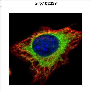 GANAB / Alpha Glucosidase II Antibody (aa47-251)