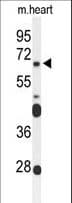 Polyclonal Rabbit anti-Human FZD4 / Frizzled 4 Antibody (aa495-522, WB)