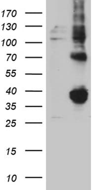 Monoclonal Mouse anti-Human FOLR3 Antibody (clone OTI7E10, Carrier-free, IHC, WB)