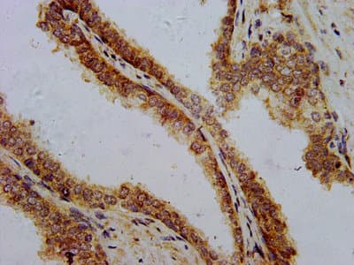 Polyclonal Rabbit anti-Human PTH / Parathyroid Hormone Antibody (WB)