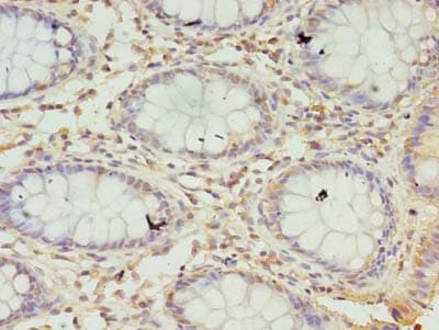 Polyclonal Rabbit anti-Human SPC18 / SEC11A Antibody (IHC)