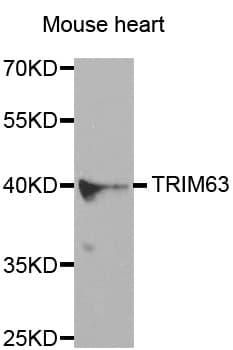 MURF1 / IRF Antibody