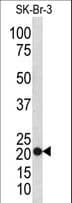 TAGLN / Transgelin / SM22 Antibody (aa24-51)