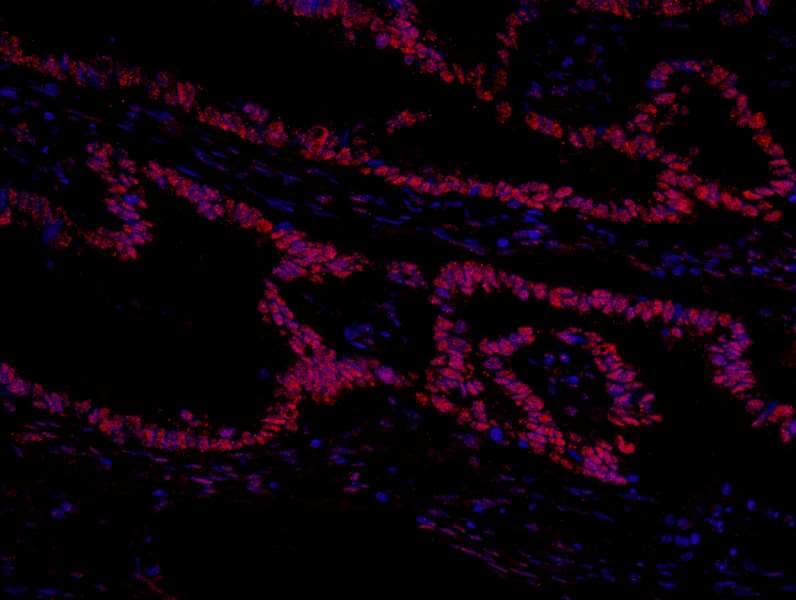 Polyclonal Rabbit anti-Human GTF2I / TFII I Antibody (aa985-998, IHC, IF)