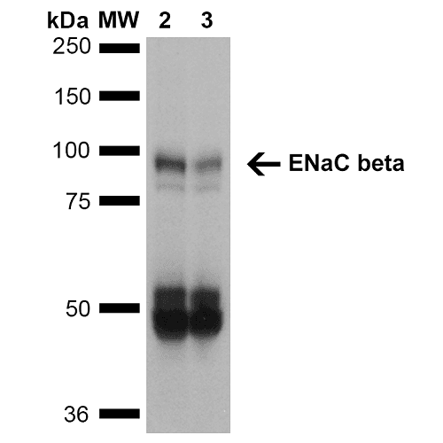 SCNN1B / ENaC Beta Antibody (clone 7B8, FITC)