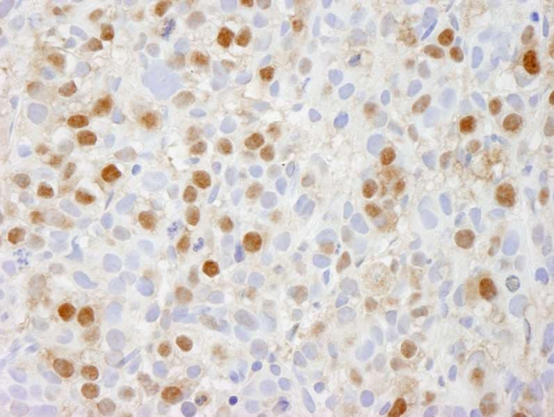 PSMC5 / SUG1 Antibody (aa1-50)