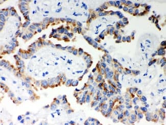 ITPR3 Antibody