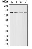 IHC-plus™ Polyclonal Rabbit anti-Human ADCY4 / Adenylate Cyclase 4 Antibody (Internal, IHC, WB)