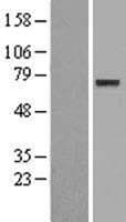 ENOX1 / CNOX Protein (Over-Expression Lysate Myc-DDK (Flag))