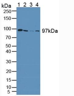 PYGL Antibody (aa370-538, Biotin)