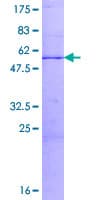 Human CHMP1A Protein (Recombinant GST)