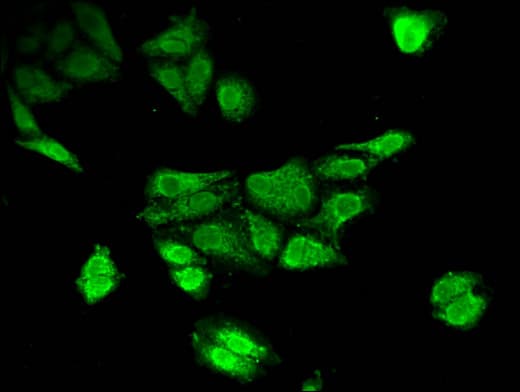 TPH2 Antibody
