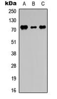 DDX3Y Antibody (N-Terminus)