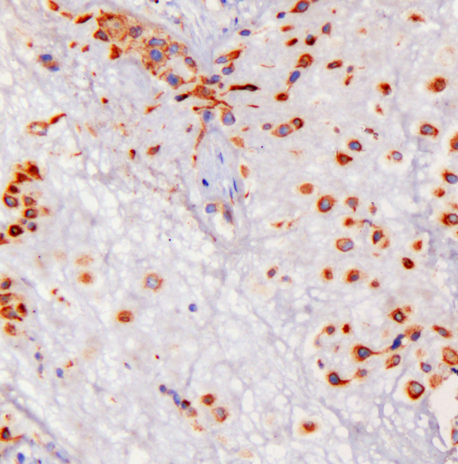 Polyclonal Rabbit anti-Human GOLPH3 Antibody (IHC, WB)