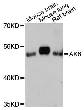 Polyclonal Rabbit anti-Human AK8 Antibody (WB)