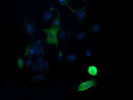 MAP2K1 / MKK1 / MEK1 Antibody (clone OTI4E4)