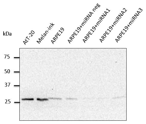 RAB27A / RAB27 Antibody (C-Terminus)