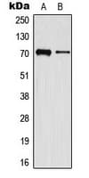 MMP16 Antibody (C-Terminus)