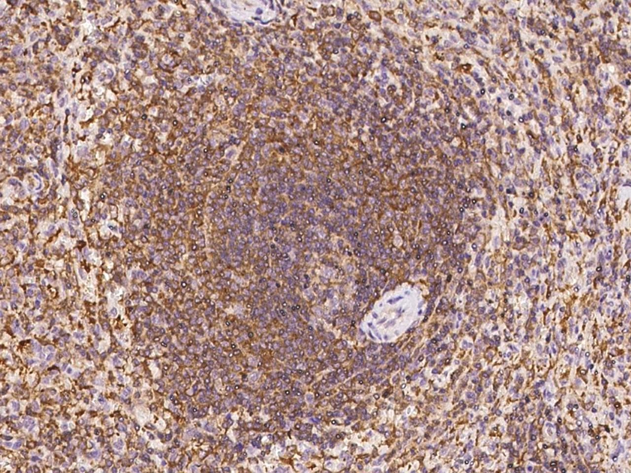 ARHGAP4 Antibody