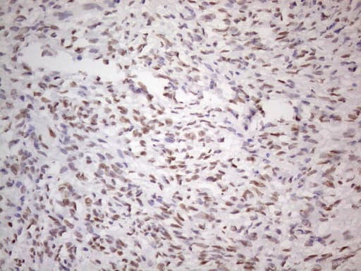 TLK2 Antibody (aa1-296, clone OTI2D10)