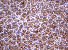 CD30 Antibody (clone OTI16H5)