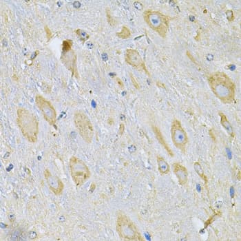 TXNDC5 / ERP46 Antibody