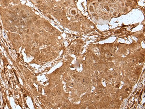 LIPG / Endothelial Lipase Antibody