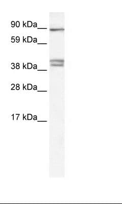 CLCNKB Antibody (C-Terminus)