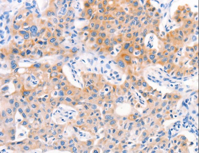 F13A1 / Factor XIIIa Antibody