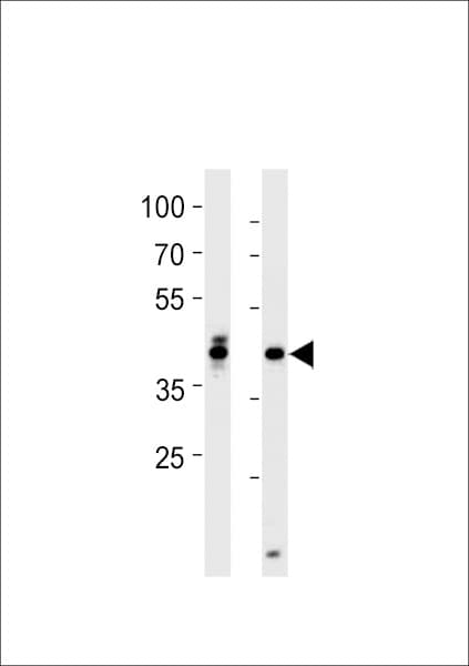 Polyclonal Rabbit anti-Zebrafish HOXD1 Antibody (aa192-219, WB)