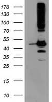 SERPINB13 / HUR7 Antibody (clone OTI2F5)