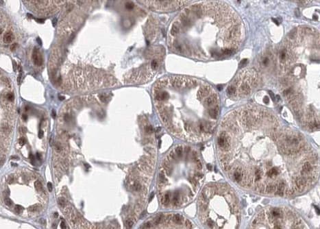 Polyclonal Rabbit anti-Human CAMK2A / CaMKII Alpha Antibody (phospho-Thr305, IHC, IF, WB)