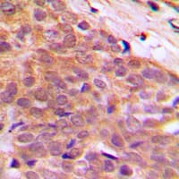 Polyclonal Rabbit anti-Human IK3-1 / CABLES1 Antibody (C-Terminus, IHC, IF, WB)